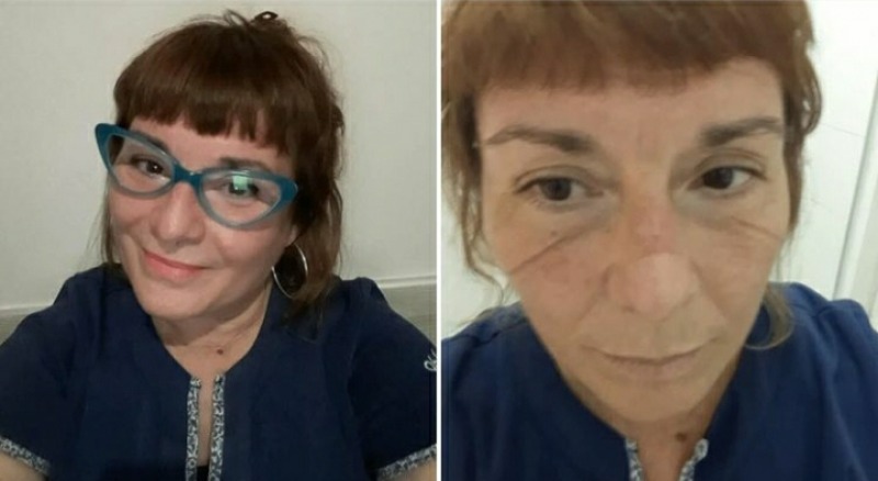 El antes y despu�s de una guardia 